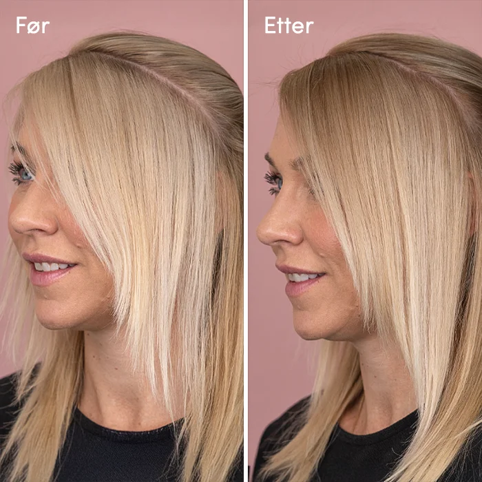 MiniColor & toning